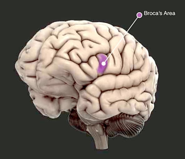 Broca's area